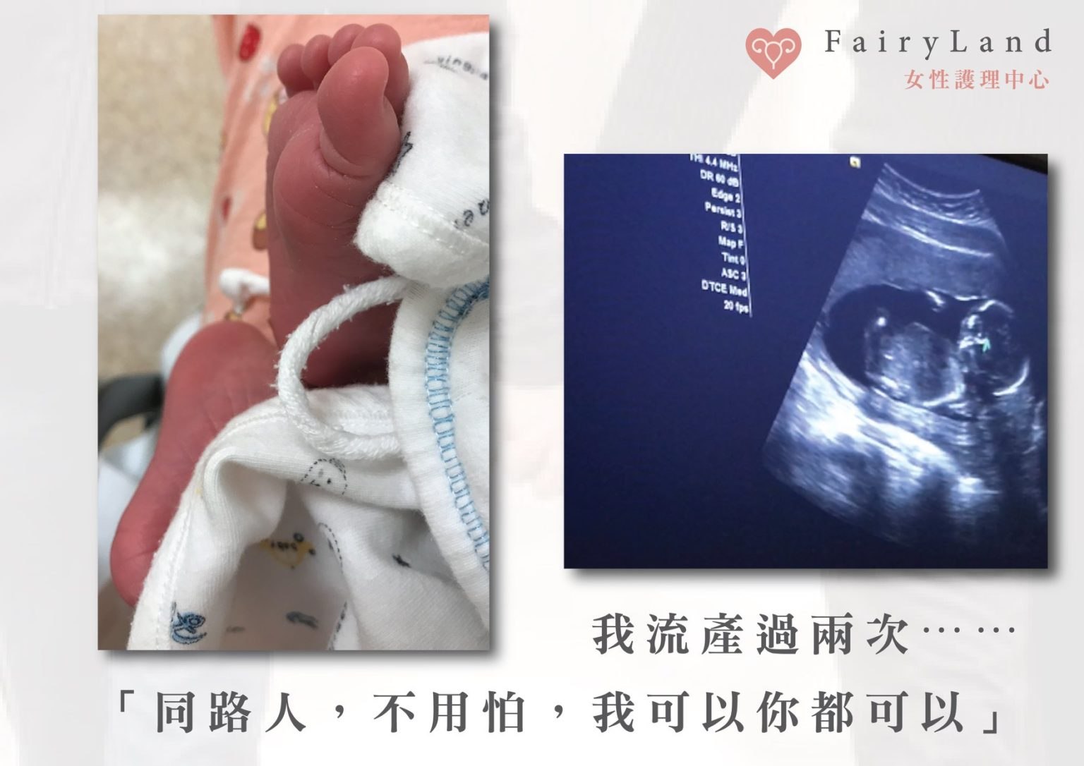 38歲【經歷流產2次】 終於成功懷孕