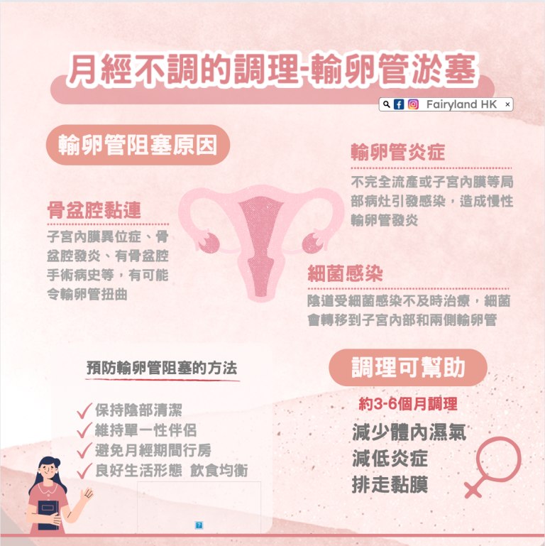 女性不孕調理-輸卵管淤塞