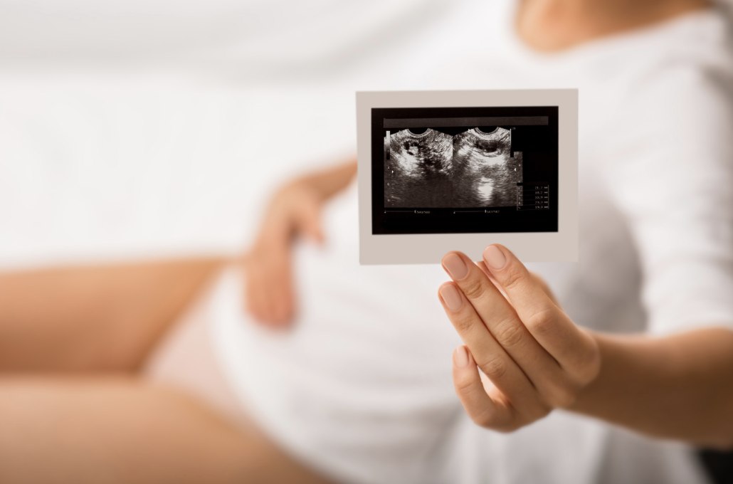 備孕做好八件事 準備IVF IUI 都適用