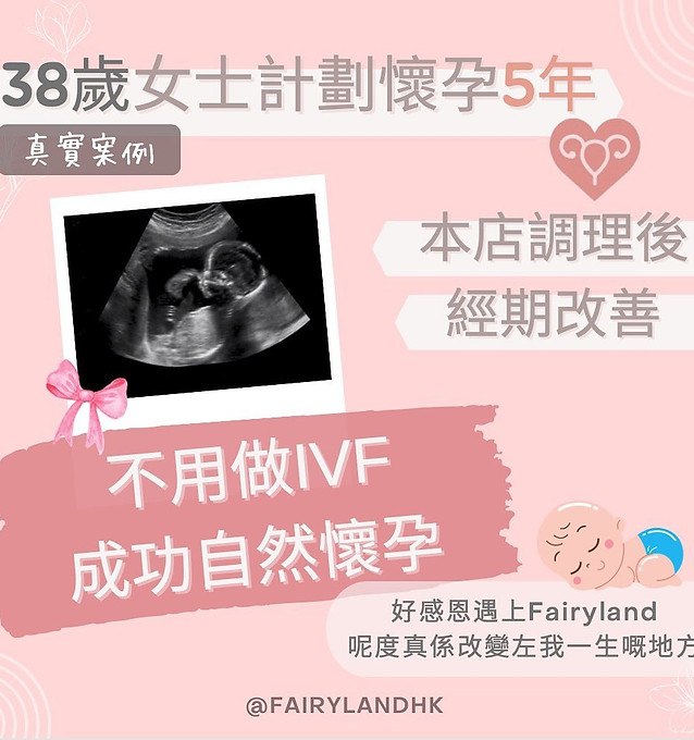 Fairyland 客人見證 12